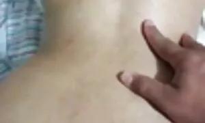 Nan prolaps anal mad ...