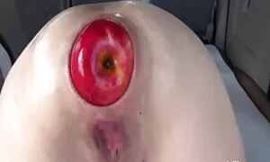 Anal fisting ekstrèm ...