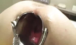 Anal, gwo ak brital  ...